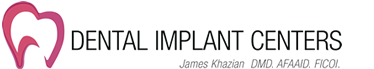Dental Implant Center San Diego